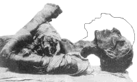 Oprav�me-li zlomeninu kr�n� p�te�e zaujme hlava Ramsese II. zn�mou polohu becht�revika.